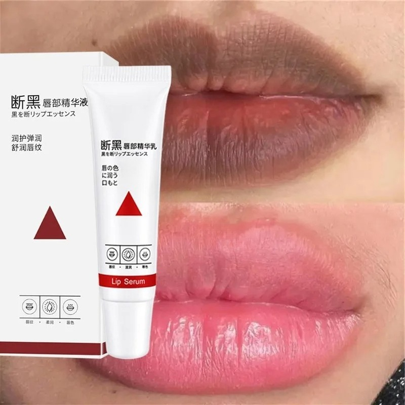Korean Lifestyle Products - Remove Dark Lip Balm Fast Lightening