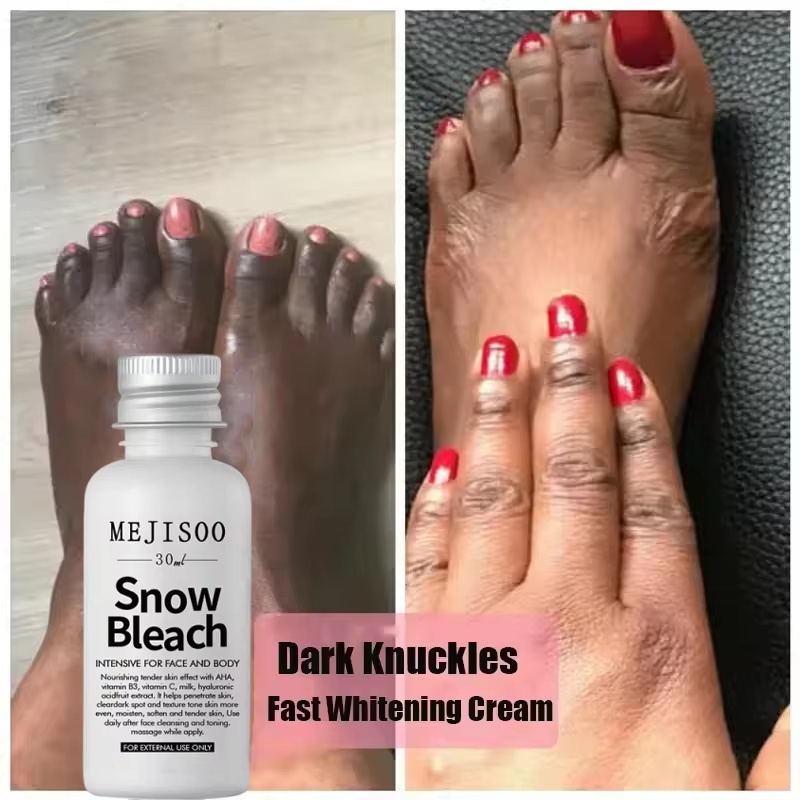 Fast Whitening Dark Knuckles B - Korean Lifestyle Products ulasan dan harga