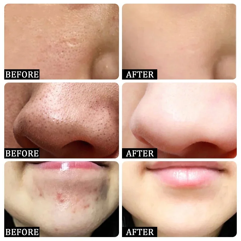 Salicylic Acid Pore Clearing C - Korean Lifestyle Products ulasan dan harga