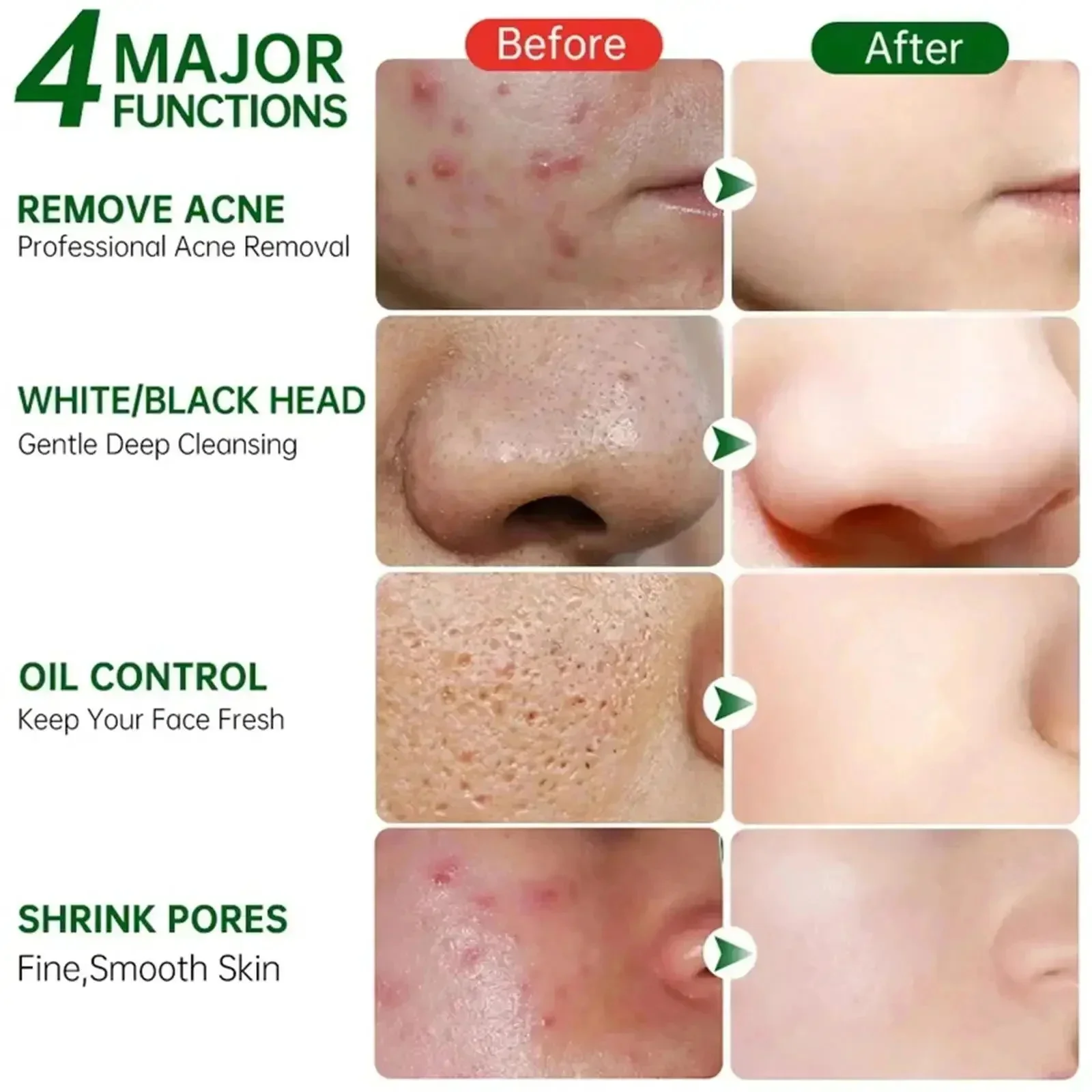 Salicylic Acid Pore Clearing C - Korean Lifestyle Products ulasan dan harga