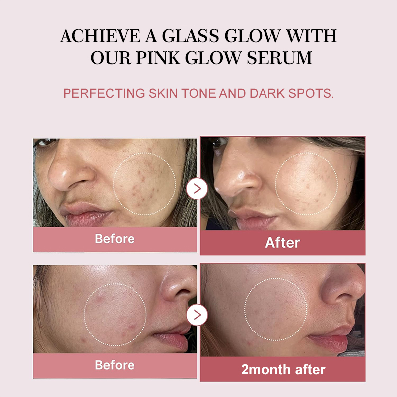 Salmon PDRN Collagen Peptide F - Korean Lifestyle Products ulasan dan harga