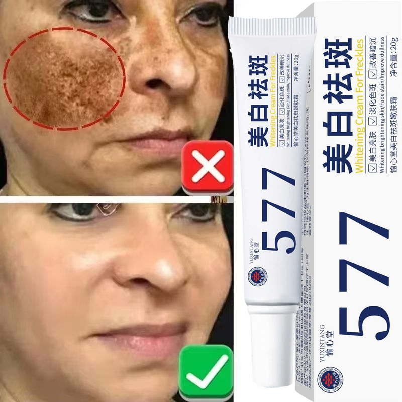 Whitening Freckle Cream Melasm - Korean Lifestyle Products ulasan dan harga