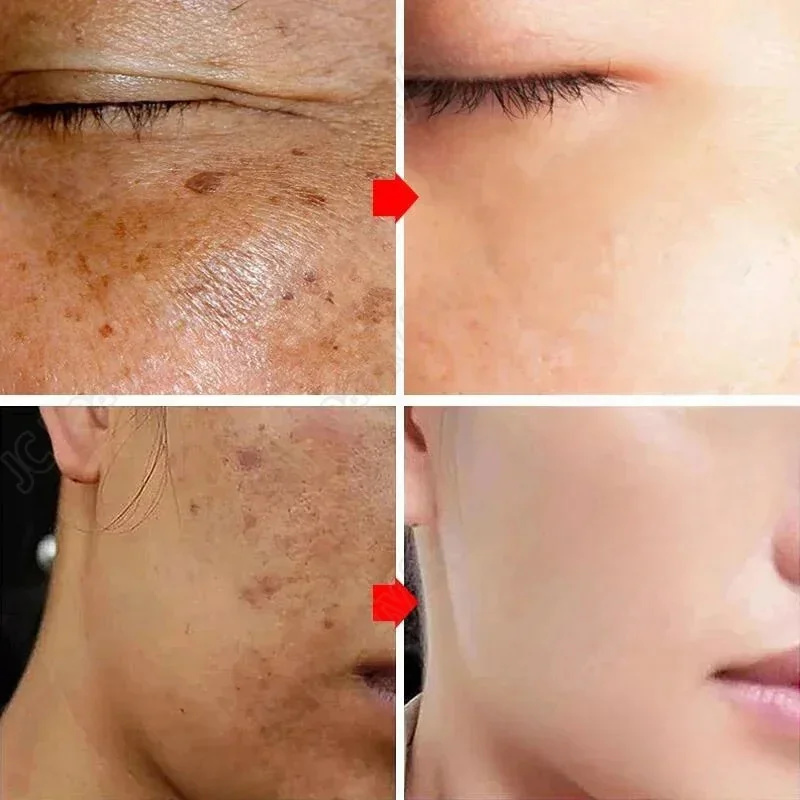 Whitening Freckle Cream Melasm - Korean Lifestyle Products ulasan dan harga