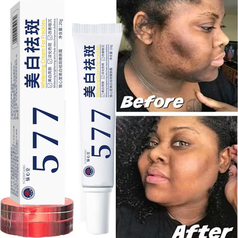 Whitening Freckle Cream Melasm - Korean Lifestyle Products ulasan dan harga