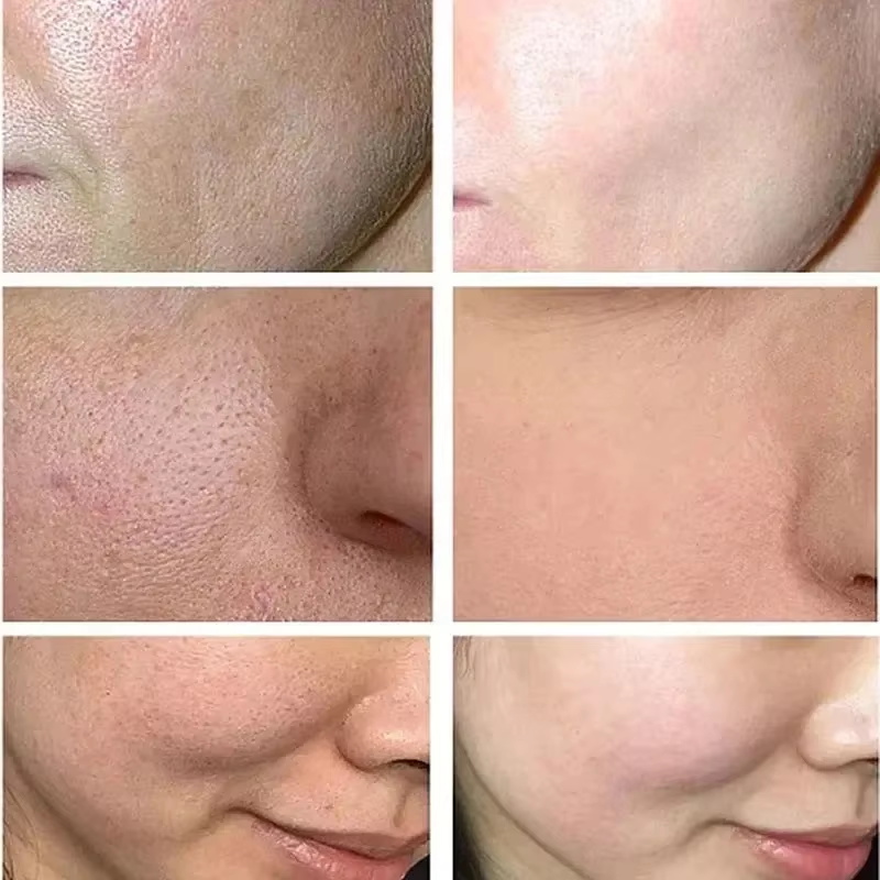 Salicylic Acid Pore Shrinking  - Korean Lifestyle Products ulasan dan harga