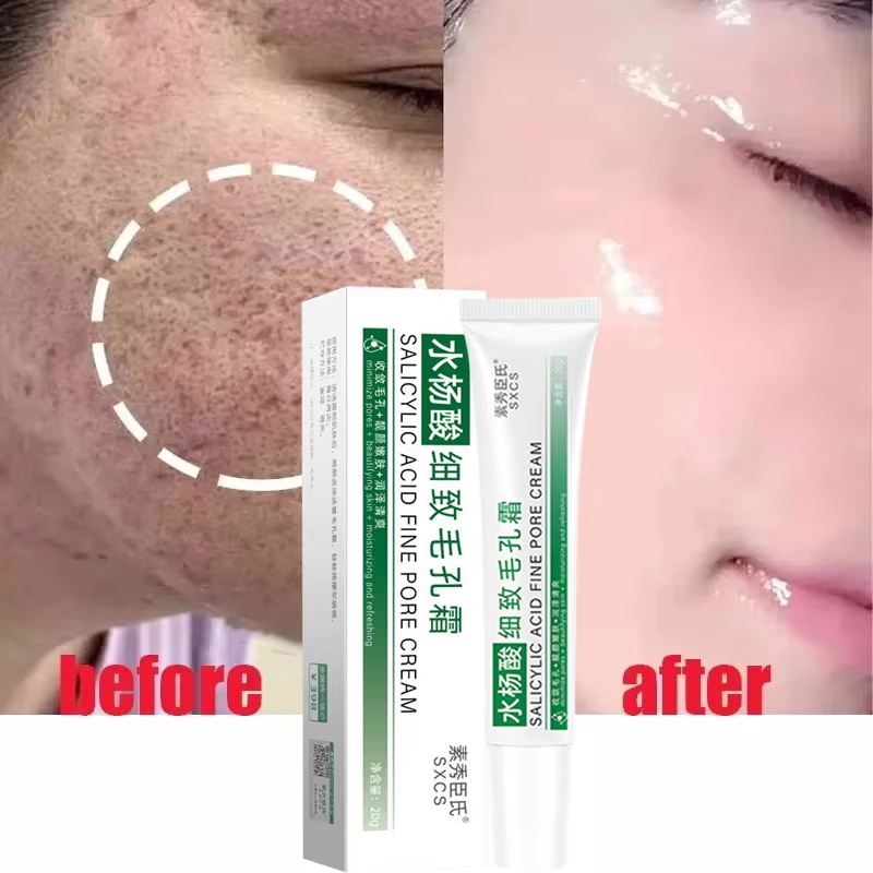 Salicylic Acid Pore Shrinking  - Korean Lifestyle Products ulasan dan harga