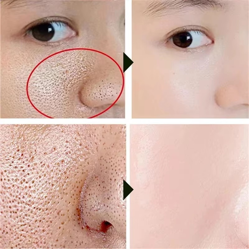 Salicylic Acid Pore Shrinking  - Korean Lifestyle Products ulasan dan harga